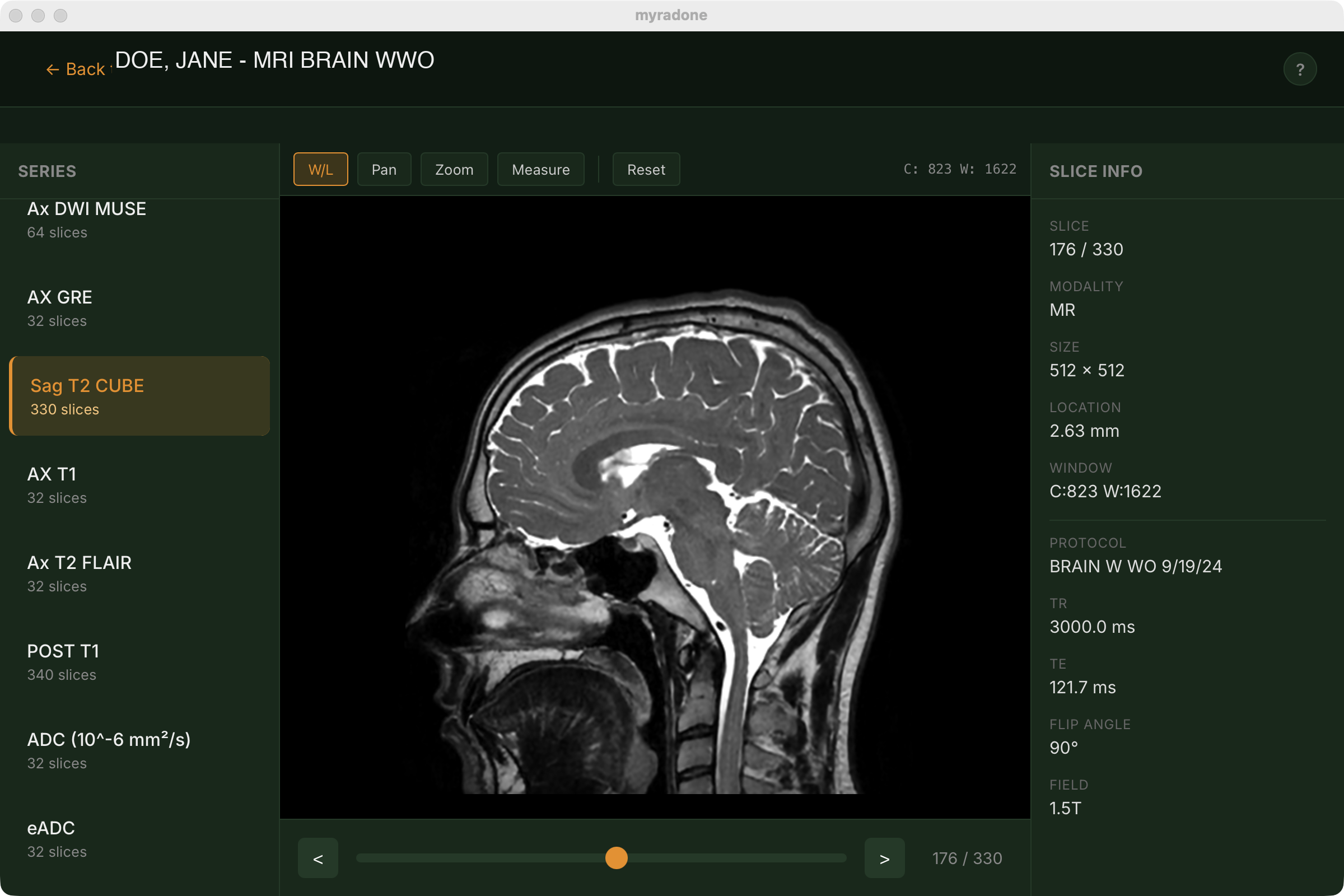 myRadOne viewer showing an MRI brain scan with clinical tools, series navigation, and slice metadata
